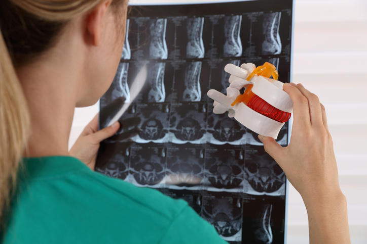 Back pain relief concept. Doctor chiropractor explains causes of back pain lumbar spine disk model spinal decompression therapy houston